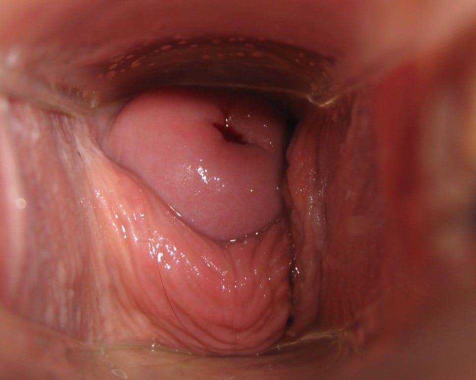 Effects Of Vaginal Conjugated Equine Estrogens And Ospemifene On The Rat Vaginal Wall And Lower Urinary Tract